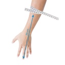 limbo-cast-protector-size-hand.jpg